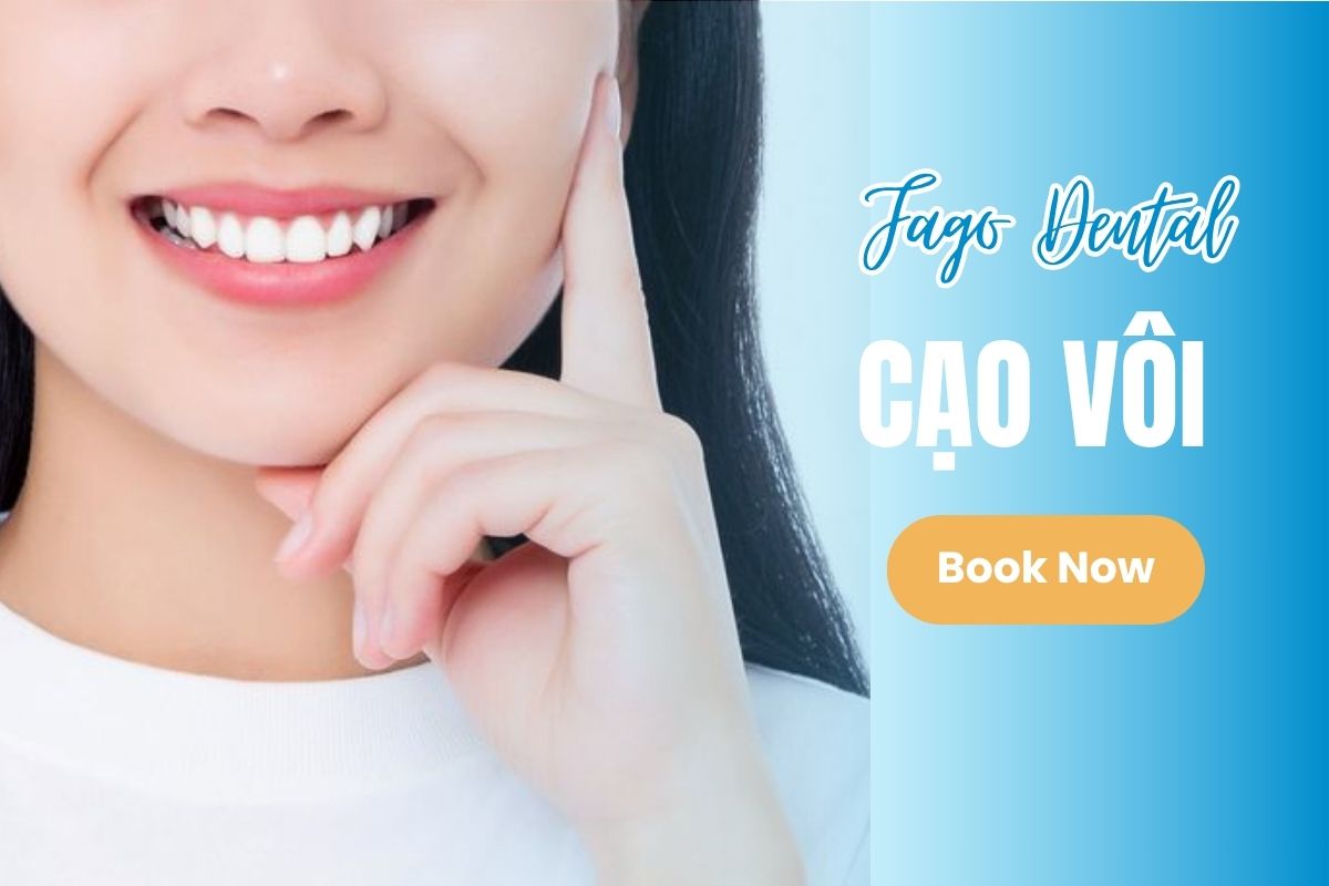 Cạo Vôi Răng