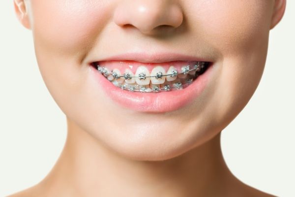 Làm Răng Có Thay Đổi Vận Mệnh Không? Có Thu Hút Được Tiền Tài?